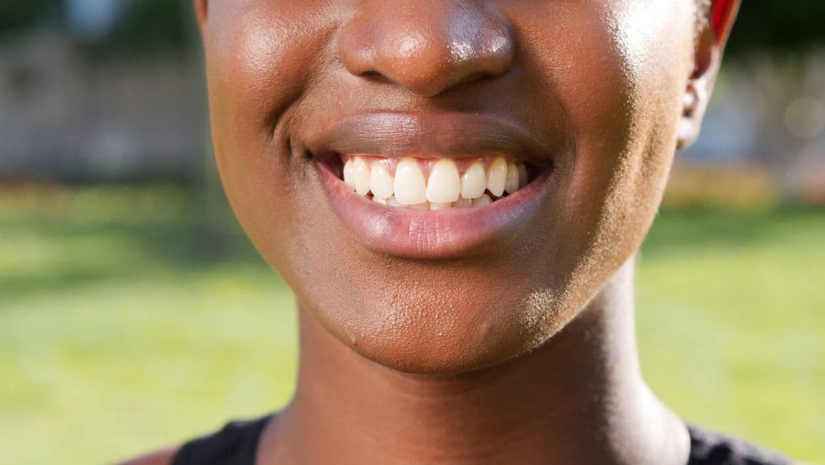 Dental Jewellery at Care Plus Dental Clinic