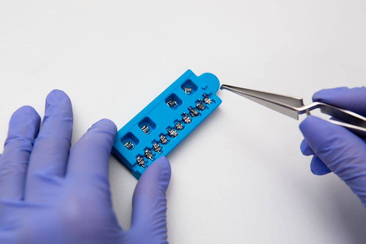 Orthodontic Treatment at Care Plus Dental Clinic