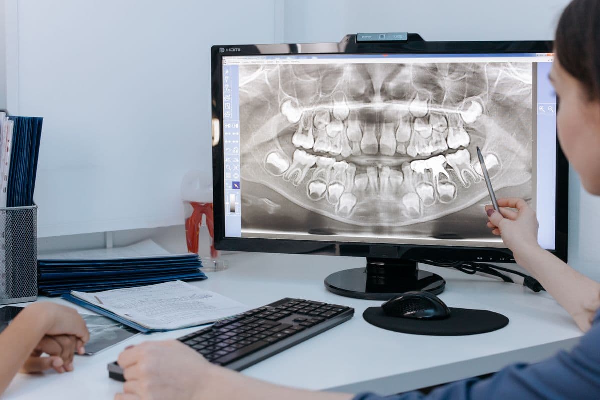 Root Canal Treatment (RCT) at Care Plus Dental Clinic
