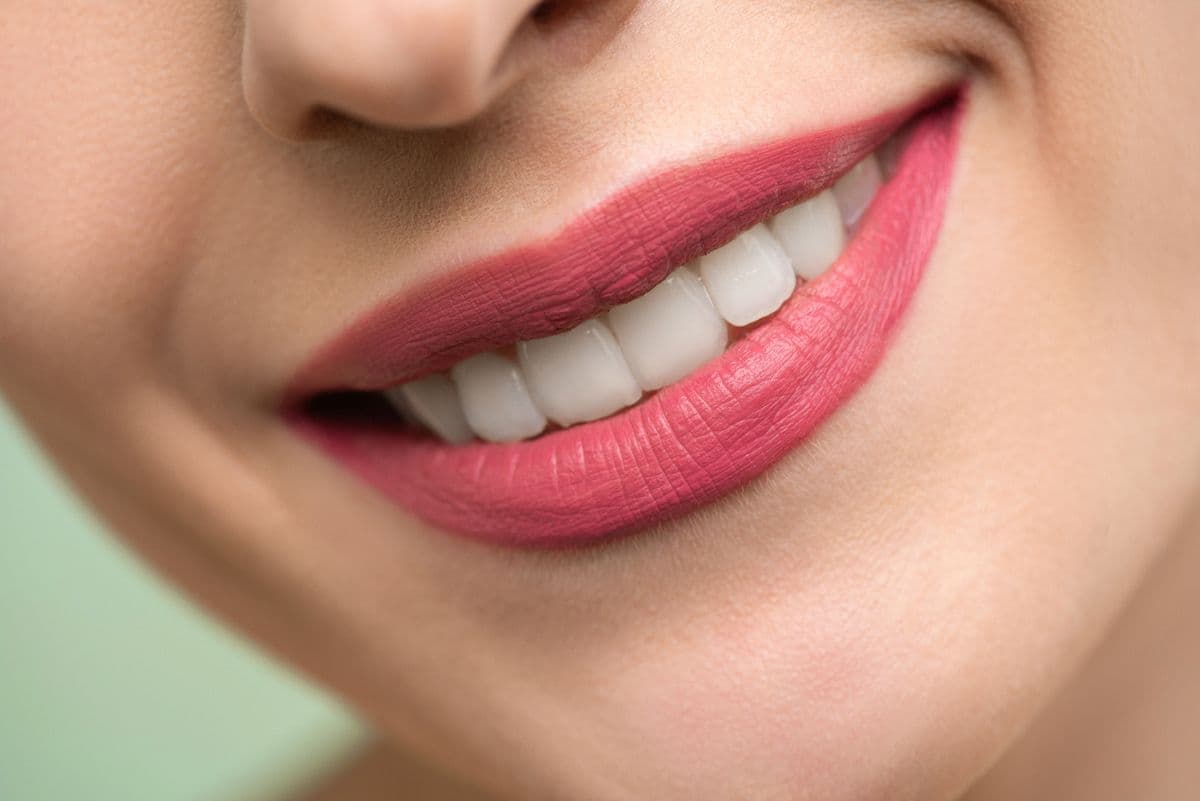 Smile Design / Veneers at Care Plus Dental Clinic